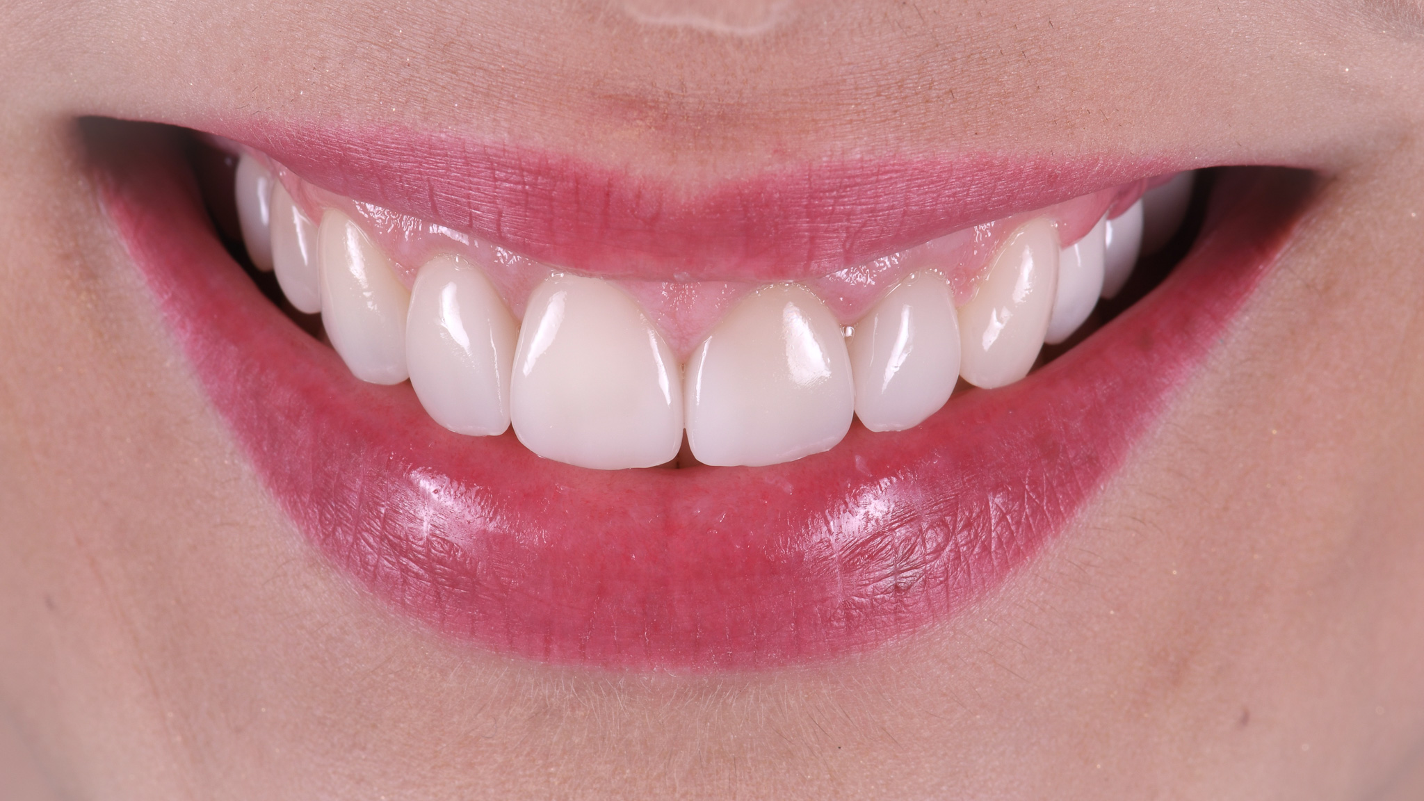 Helykitöltő kép előtte -utána kompozícióhoz