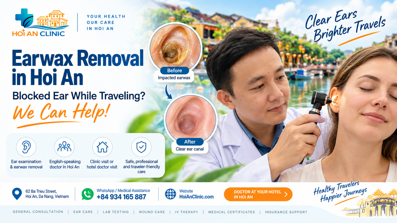 Earwax Removal in Hoi An: Blocked Ear While Traveling